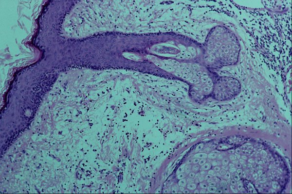 440051 Scalp Skin A4 Photo Print