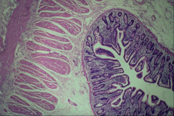 440053 Normal Ileum A4 Photo Print