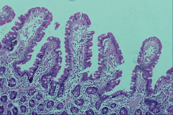 440055 Duodenum A4 Photo Print