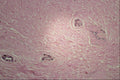 440056 Breast, Normal, 19 Years A4 Photo Print