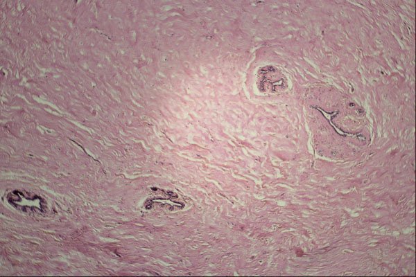 440056 Breast, Normal, 19 Years A4 Photo Print