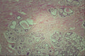 440057 Breast, Pregnant, 22 Years A4 Photo Print