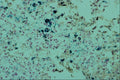 440060 Haemosiderin A4 Photo Print