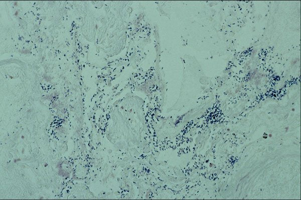 440061 Bacteria A4 Photo Print
