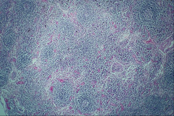 440062 Lymph Node A4 Photo Print