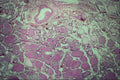 440064 Thyroid A4 Photo Print