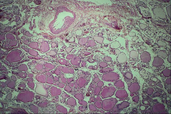 440064 Thyroid A4 Photo Print