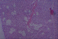 440066 Normal Parathyroid A4 Photo Print