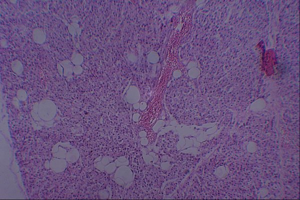 440066 Normal Parathyroid A4 Photo Print