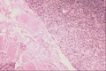 440067 Normal Parathyroid And Thyroid A4 Photo Print