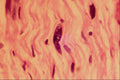 440068 Nerve A4 Photo Print