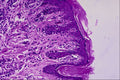 440071 Compound Neavus A4 Photo Print