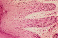 440078 Senile Keratosis A4 Photo Print