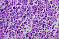 440081 Candida In Inflammatory Exudate A4 Photo Print