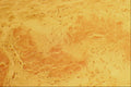 440083 Myocardium Amyloid A4 Photo Print