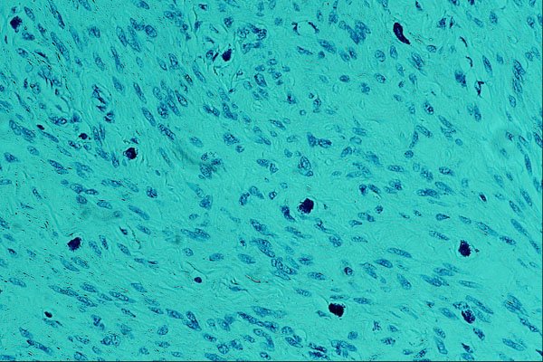 440086 Mast Cells A4 Photo Print