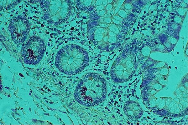 440087 Paneth Cells A4 Photo Print