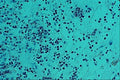 440088 Eosinophils A4 Photo Print