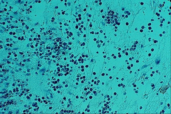 440088 Eosinophils A4 Photo Print