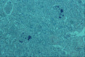 440089 Fibrin A4 Photo Print