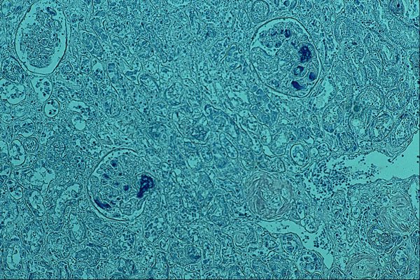 440089 Fibrin A4 Photo Print