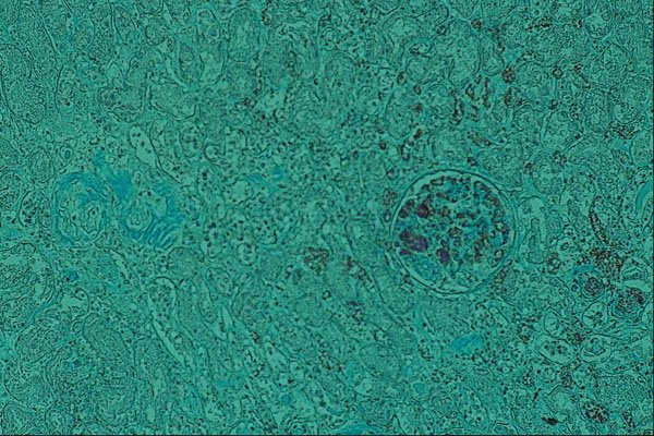 440090 Fibrin A4 Photo Print