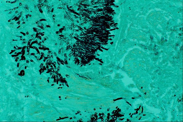 440091 Aspergillus A4 Photo Print