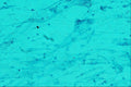 440092 Acid Fast Bacilli A4 Photo Print
