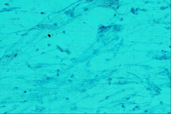 440092 Acid Fast Bacilli A4 Photo Print