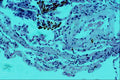 440093 Asbestos Bodies A4 Photo Print