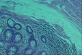 440095 Normal Appendix A4 Photo Print