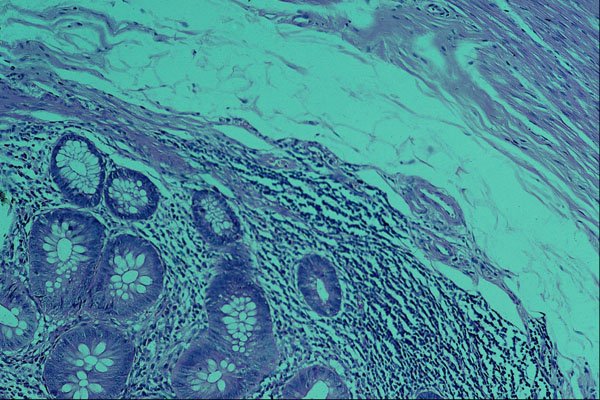 440095 Normal Appendix A4 Photo Print