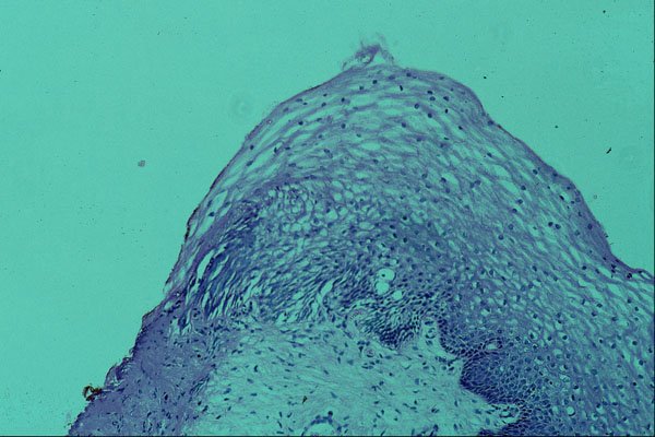 440096 Endocervical Junction A4 Photo Print