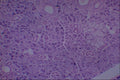440098 Submandibular Salivary Gland A4 Photo Print