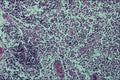 440099 Infant Parathyroid A4 Photo Print