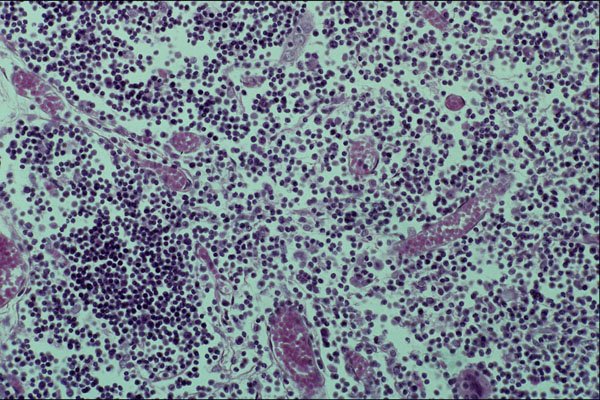 440099 Infant Parathyroid A4 Photo Print