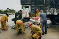 505096 Burn Victim, Accident Involving Hot Roadway Tar Transport A4 Photo Print