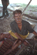 590057 Cambodian Truck Driver Burned In Rocket Attack A4 Photo Print