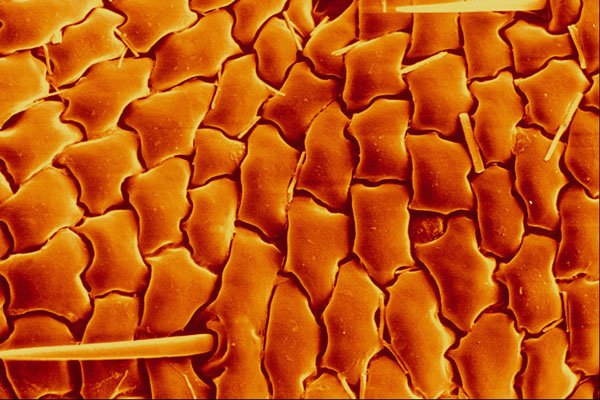 645030 Hair Louse Side A4 Photo Print