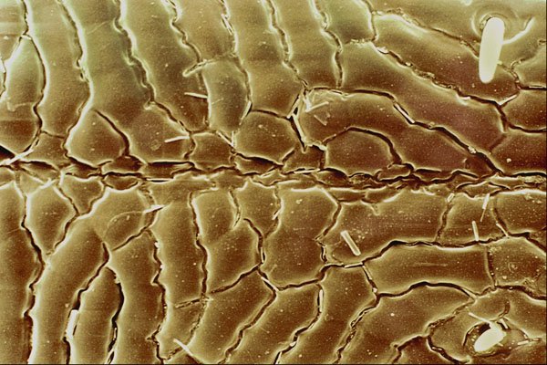 645066 Hair Louse Chest A4 Photo Print