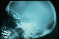 686006 X ray Of Head A4 Photo Print