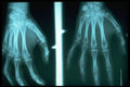 686007 X ray Of Hands A4 Photo Print