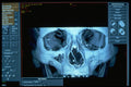 686009 Radiology Software A4 Photo Print