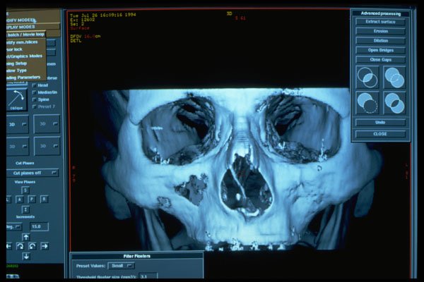 686009 Radiology Software A4 Photo Print
