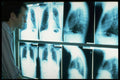 686010 Doctor At X rays A4 Photo Print