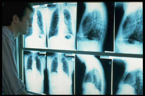 686010 Doctor At X rays A4 Photo Print