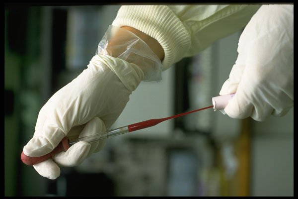 686014 Technician Taking Blood Sample A4 Photo Print