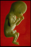 686035 Fetus, 14 Weeks (82mm Crown To Rump) A4 Photo Print