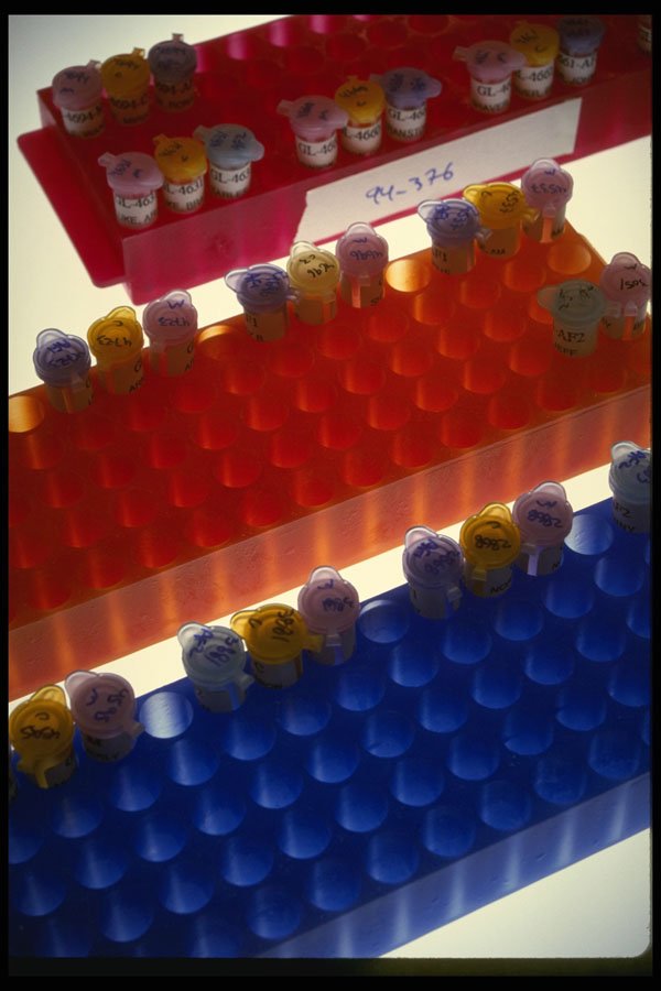 686037 Chilled Human DNA Specimen For Paternal Investigation A4 Photo Print