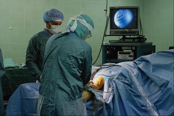 686068 Knee Surgery A4 Photo Print